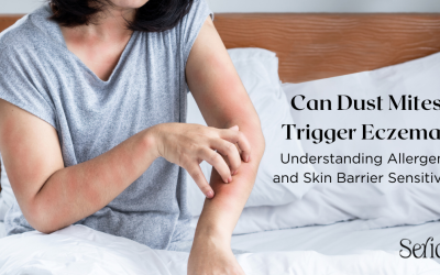 Can Dust Mites Trigger Eczema? Understanding Allergens and Skin Barrier Sensitivity